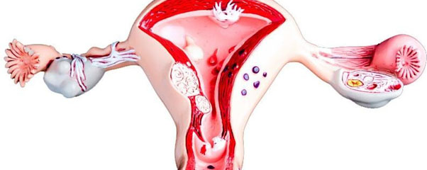 Кровотечение из женских половых органов
